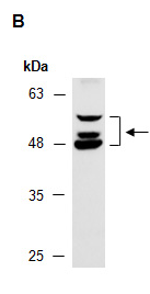 APOBEC3 (C) Antibody, Rabbit Polyclonal