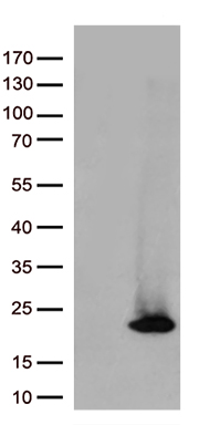 ASF1B Antibody