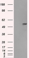 ASF1B Antibody
