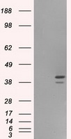 ASF1B Antibody