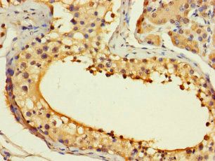 ASF1B Antibody