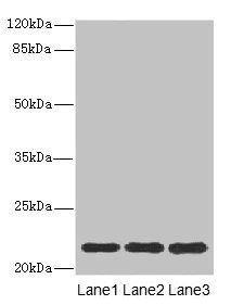 ASF1B antibody