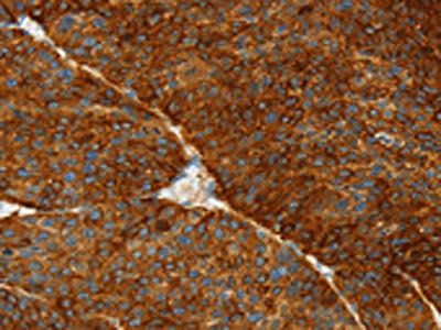 ASGR1 antibody