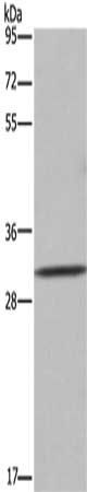 ASGR1 antibody