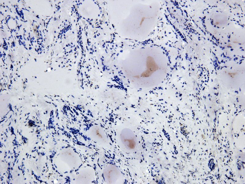 ASGR1 antibody