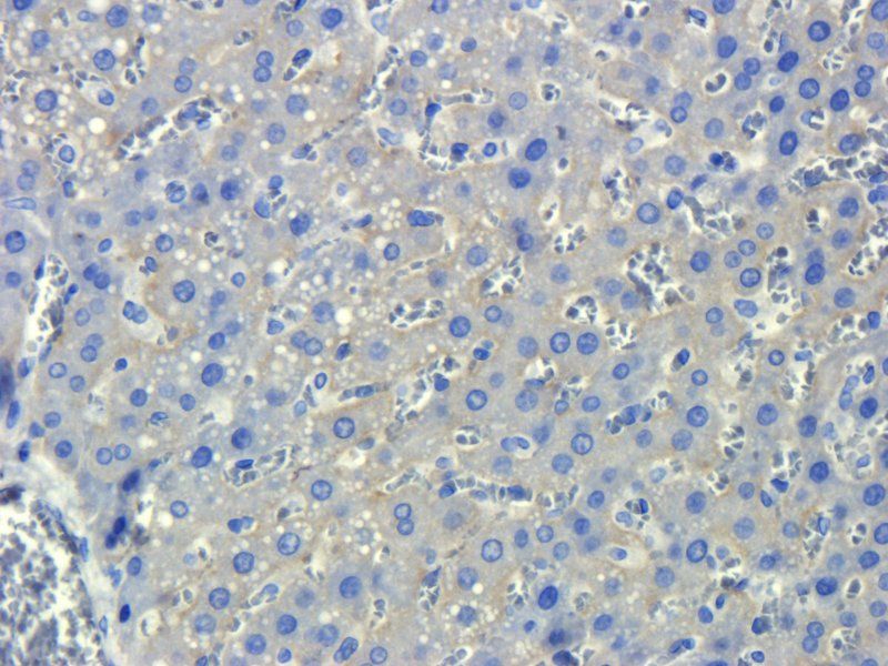 ASGR1 antibody