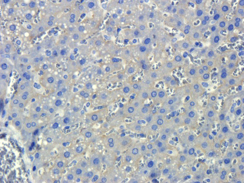 ASGR1 antibody