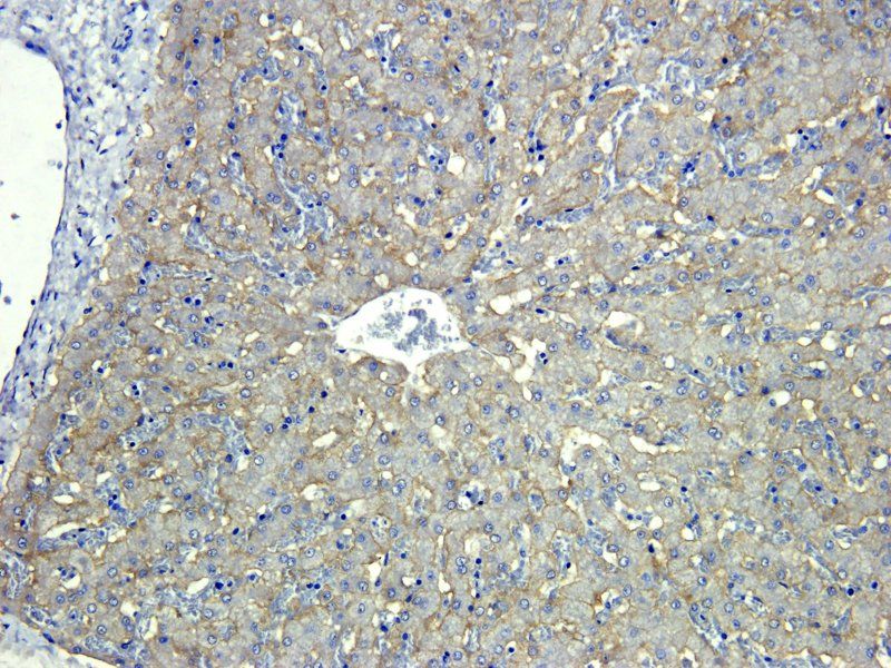 ASGR1 antibody