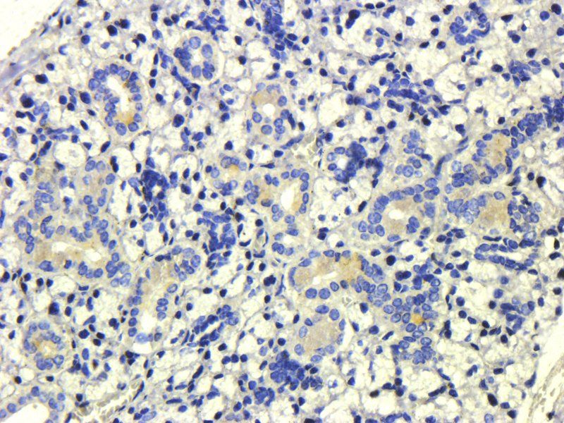 ASGR1 antibody