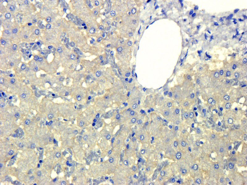 ASGR1 antibody