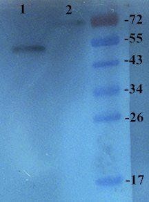 ASGR1 antibody