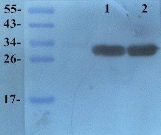 ASGR1 antibody