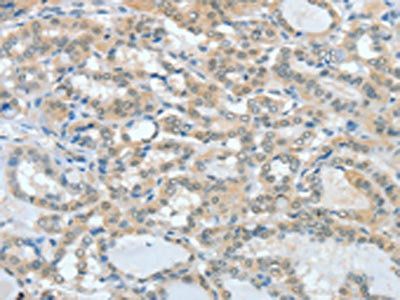 ASH2L Antibody