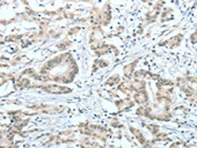 ASH2L Antibody