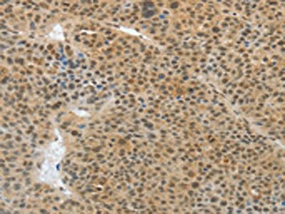 ASH2L Antibody