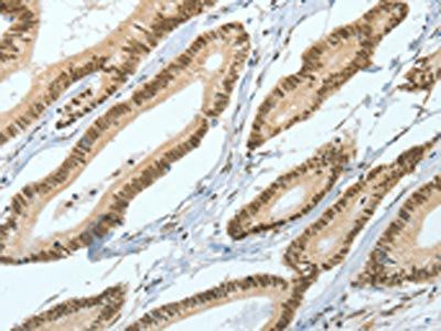 ASH2L Antibody
