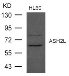ASH2L Rabbit Polyclonal Antibody