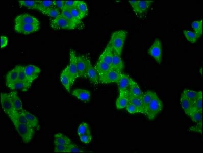 ASIC2 Antibody
