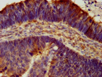 ASIC2 Antibody