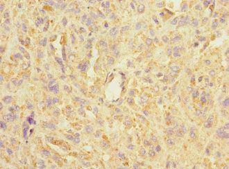 ASIC3 Antibody