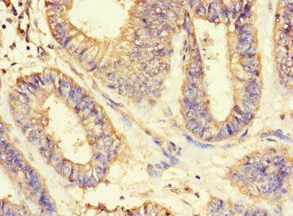 ASIP Antibody