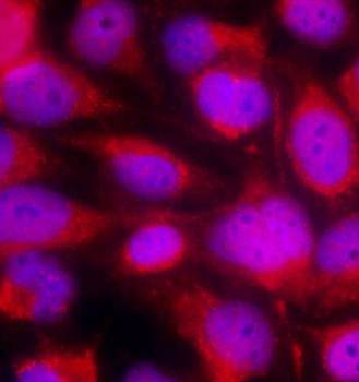 ASK1 (Ab-83) Antibody