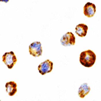 ASK1 Antibody
