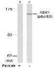 ASK1 (Phospho-Ser83) Antibody
