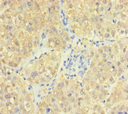 ASL Antibody