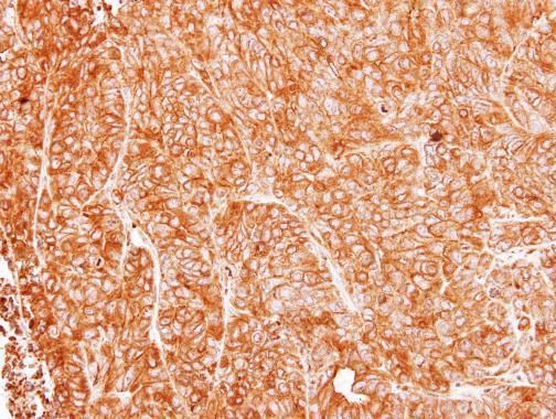 ASL antibody