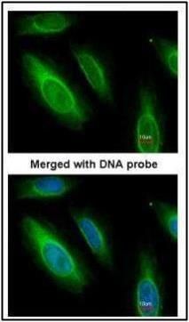 ASL antibody