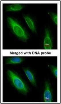 argininosuccinate lyase Antibody