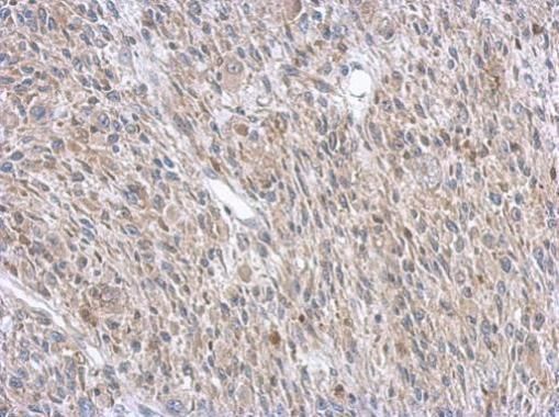 ASL antibody
