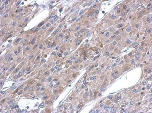 ASL antibody