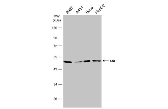 argininosuccinate lyase Antibody