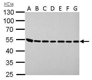 argininosuccinate lyase Antibody