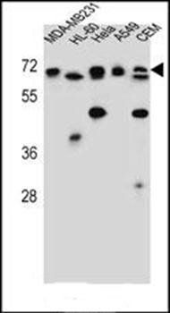 ASMTL antibody
