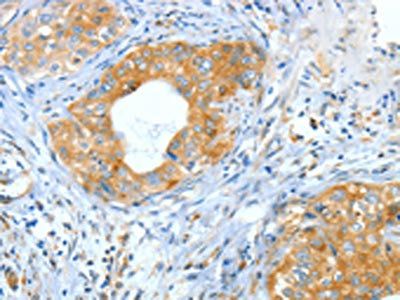 ASNS Antibody