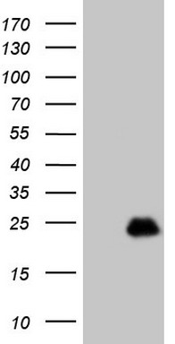 ASPA Antibody