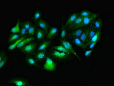 Aspartate aminotransferase, cytoplasmic antibody