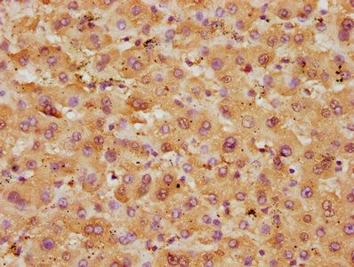 GOT1 Antibody
