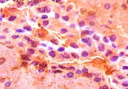 GOT1 Antibody