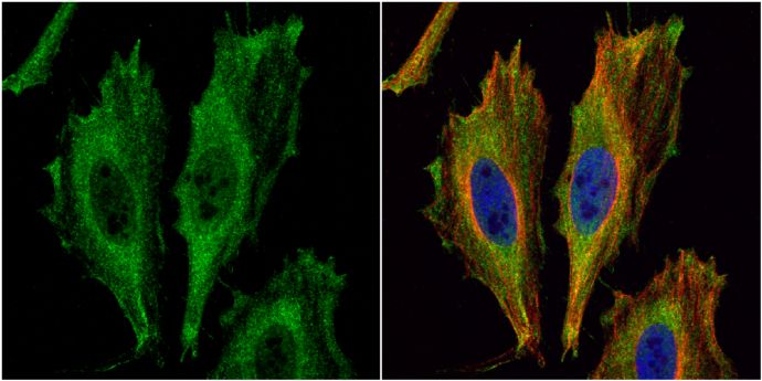 Aspartoacylase Rabbit Polyclonal Antibody