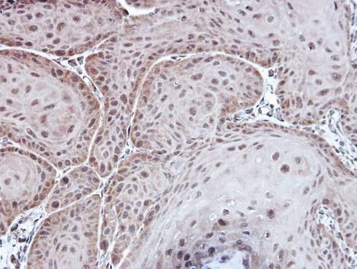 Aspartoacylase Rabbit Polyclonal Antibody
