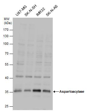 Aspartoacylase Rabbit Polyclonal Antibody