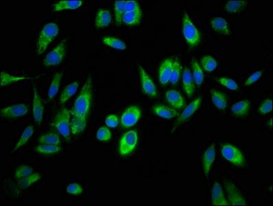 Aspartyl/asparaginyl beta-hydroxylase antibody