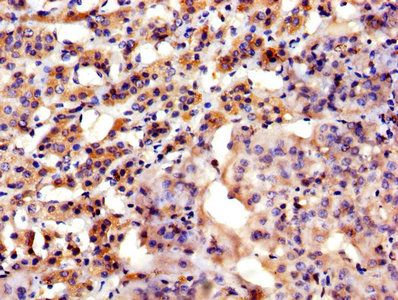 ASPH Antibody