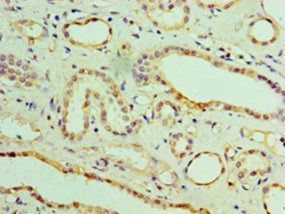 Aspartyl/asparaginyl beta-hydroxylase antibody