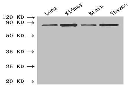 Aspartyl/asparaginyl beta-hydroxylase antibody