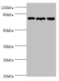 Aspartyl/asparaginyl beta-hydroxylase antibody